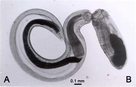  Gigantostoma Spinigerum: Een Parasitaire Worm Met een Voorliefde voor Zoogdieren en de Kunst van Subtiele Migratie!