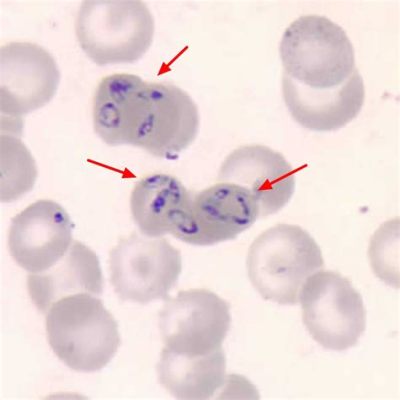  Babesia: Een microscopische parasiet die rode bloedcellen infecteert en zorgt voor een scala aan symptomen bij zijn gastheer!